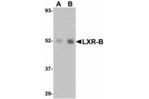 Image no. 1 for anti-Nuclear Receptor Subfamily 1, Group H, Member 2 (NR1H2) (N-Term) antibody (ABIN478107) (NR1H2 Antikörper  (N-Term))