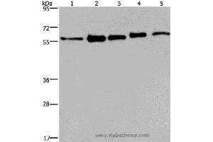 Western blot analysis of MCF-7, 293T, A549, Hela and HepG2 cell, using HNRNPL Polyclonal Antibody at dilution of 1:450 (HNRNPL Antikörper)