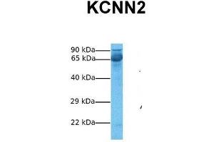 Host:  Rabbit  Target Name:  KCNN2  Sample Tissue:  Human Fetal Liver  Antibody Dilution:  1. (KCNN2 Antikörper  (C-Term))