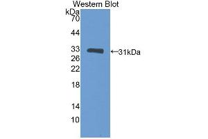 Detection of Recombinant GKRP, Mouse using Polyclonal Antibody to Glucokinase Regulatory Protein (GKRP) (GCKR Antikörper  (AA 17-261))