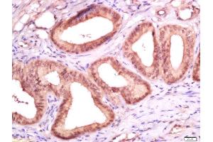 Immunohistochemistry (Paraffin-embedded Sections) (IHC (p)) image for anti-Antigen Identified By Monoclonal Antibody Ki-67 (MKI67) (AA 1201-1300) antibody (ABIN677858)