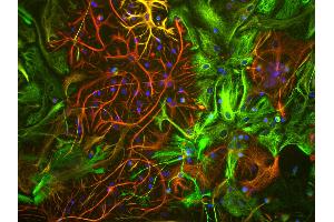 View of mixed neuron/glial cultures stained with Vimentin antibody (green) our our rabbit antibody to GFAP antibody (RPCA-GFAP, red). (Vimentin Antikörper)