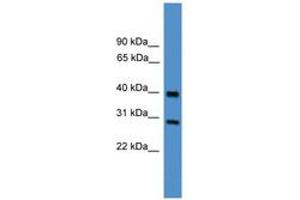 Image no. 1 for anti-Metalloproteinase Inhibitor 2 (TIMP2) (AA 130-179) antibody (ABIN6745438) (TIMP2 Antikörper  (AA 130-179))