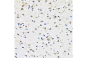 Immunohistochemistry of paraffin-embedded mouse brain using SAFB2 antibody. (SAFB2 Antikörper)