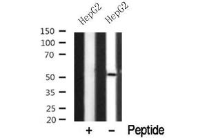 Western blot analysis of NDR1/2 in lysates of HepG2? (NDR1/2 Antikörper)