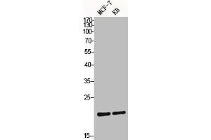 Western Blot analysis of MCF7 KB cells using Bax Polyclonal Antibody (BAX Antikörper  (N-Term))