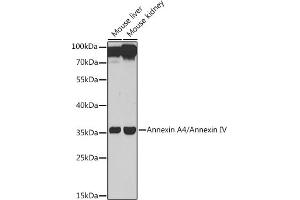 Western blot analysis of extracts of various cell lines, using Annexin /Annexin IV antibody (ABIN6127353, ABIN6136931, ABIN6136933 and ABIN6217476) at 1:1000 dilution. (Annexin IV Antikörper  (AA 112-321))