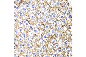 Immunohistochemistry of paraffin-embedded mouse liver using CDH2 Antibody (ABIN5995676) at dilution of 1/100 (40x lens). (N-Cadherin Antikörper)