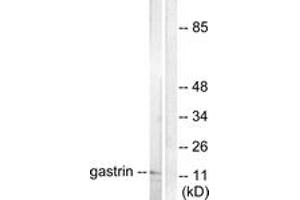 Western blot analysis of extracts from NIH-3T3 cells, using Gastrin Antibody. (Gastrin Antikörper  (AA 52-101))