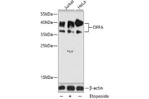 Western blot analysis of extracts of various cell lines, using DFFA antibody (ABIN6127756, ABIN6139549, ABIN6139551 and ABIN6216052) at 1:1000 dilution. (DFFA Antikörper  (AA 1-331))