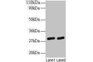 Western blot All lanes: GATD3A antibody at 2 μg/mL Lane 1: EC109 whole cell lysate Lane 2: 293T whole cell lysate Secondary Goat polyclonal to rabbit IgG at 1/15000 dilution Predicted band size: 29, 25 kDa Observed band size: 29 kDa (GATD3A (AA 43-268) Antikörper)