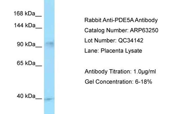 PDE5A Antikörper  (C-Term)