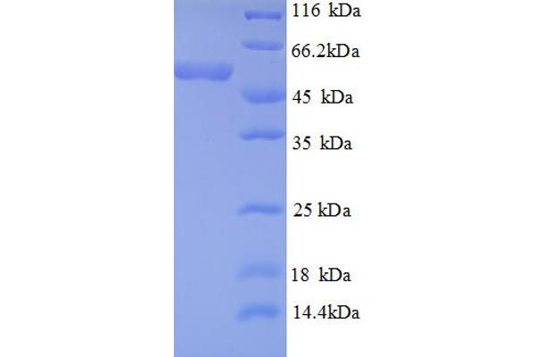 DAXX Protein (AA 1-233, partial) (GST tag)