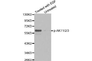 Western blot analysis of extracts from HepG2 cells untreated or treated with EGF using Phospho-AKT1/2/3-Y315/316/312 antibody (AKT 1/2/3 Antikörper  (pTyr312))