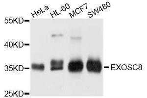 Western blot analysis of extracts of various cell lines, using EXOSC8 antibody. (EXOSC8 Antikörper  (AA 1-276))