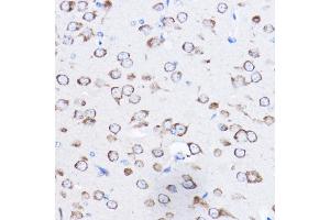 Immunohistochemistry of paraffin-embedded mouse brain using RPL8 Rabbit pAb (ABIN6128659, ABIN6147155, ABIN6147156 and ABIN6214154) at dilution of 1:50 (40x lens). (RPL8 Antikörper  (AA 1-257))