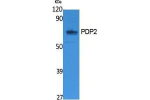 Western Blotting (WB) image for anti-Pyruvate Dehyrogenase Phosphatase Catalytic Subunit 2 (PDP2) (Internal Region) antibody (ABIN3178105) (PDP2 Antikörper  (Internal Region))