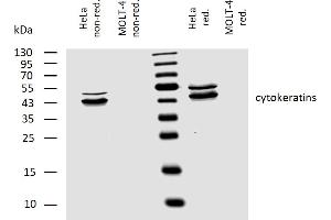 Western Blotting (WB) image for anti-pan Keratin (panKRT) antibody (ABIN94275)