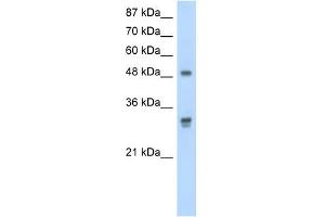 DDX19B antibody used at 2. (DDX19B Antikörper)