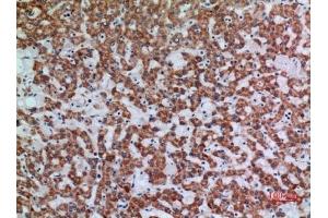 Immunohistochemical analysis of paraffin-embedded human-liver, antibody was diluted at 1:100. (APAF1 Antikörper  (Internal Region))