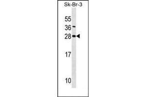 Western blot analysis of SDC4 Antibody (Center) Cat. (SDC4 Antikörper  (Middle Region))
