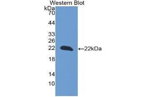 Detection of Recombinant PARK7, Rat using Monoclonal Antibody to Parkinson Disease Protein 7 (PARK7) (PARK7/DJ1 Antikörper  (AA 1-189))