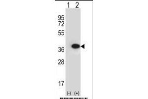 Western blot analysis of ANXA2 (arrow) using rabbit polyclonal ANXA2 Antibody (N-term) (ABIN391619 and ABIN2841538). (Annexin A2 Antikörper  (N-Term))