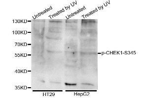 Western blot analysis of extracts of various cell lines, using Phospho-CHEK1-S345 antibody (ABIN5995617). (CHEK1 Antikörper  (pSer345))