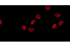 ABIN6274090 staining K562 by IF/ICC. (OVOL1 Antikörper  (N-Term))