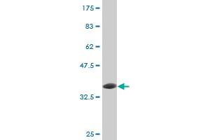 Western Blot detection against Immunogen (36. (ube3a Antikörper  (AA 51-150))