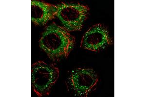 Fluorescent image of A549 cell stained with FADS2 Antibody (N-term). (FADS2 Antikörper  (N-Term))