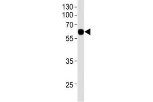 Western blot analysis of recombinant protein using KLF4 antibody at 1:1000. (KLF4 Antikörper)