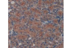 Used in DAB staining on fromalin fixed paraffin- embedded kidney tissue (UQCRB Antikörper  (AA 4-111))