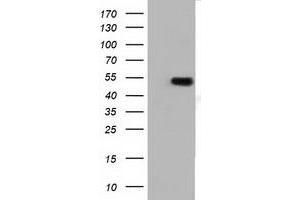 HEK293T cells were transfected with the pCMV6-ENTRY control (Left lane) or pCMV6-ENTRY TUBA3E (Right lane) cDNA for 48 hrs and lysed. (TUBA3E Antikörper)