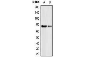 Western blot analysis of GUCY1B2 expression in HL60 (A), Jurkat (B) whole cell lysates. (GUCY1B2 Antikörper  (N-Term))