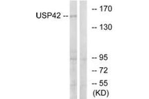Western blot analysis of extracts from HT-29 cells, using USP42 Antibody. (USP42 Antikörper  (AA 251-300))
