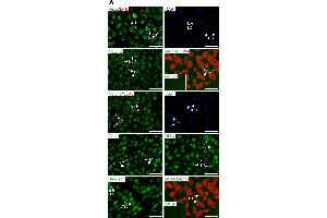 Immunofluorescence (Cultured Cells) (IF (cc)) image for anti-Vimentin (VIM) antibody (ABIN2854814)