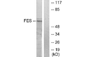 Western blot analysis of extracts from HUVEC cells, treated with serum (20%, 30mins), using FES antibody. (FES Antikörper  (Internal Region))