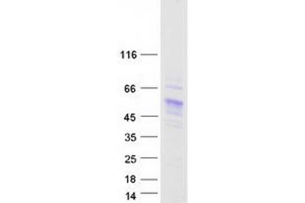 CES5A Protein (Transcript Variant 2) (Myc-DYKDDDDK Tag)