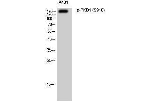 Western Blotting (WB) image for anti-Polycystic Kidney Disease 1 (Autosomal Dominant) (PKD1) (pSer910) antibody (ABIN3173025) (PKD1 Antikörper  (pSer910))