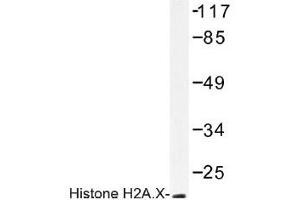 Image no. 1 for anti-H2A Histone Family, Member X (H2AFX) antibody (ABIN317713) (H2AFX Antikörper)