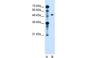 WB Suggested Anti-ZFYVE27 Antibody Titration:  1. (ZFYVE27 Antikörper  (Middle Region))