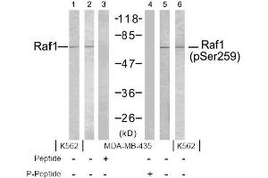 Image no. 2 for anti-V-Raf-1 Murine Leukemia Viral Oncogene Homolog 1 (RAF1) (pSer259) antibody (ABIN196619) (RAF1 Antikörper  (pSer259))