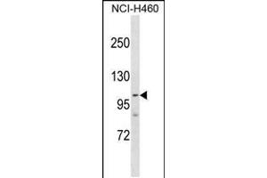 Western blot analysis in NCI-H460 cell line lysates (35ug/lane). (PARP1 Antikörper  (AA 590-618))