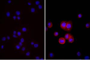 Human pancreatic carcinoma cell line MIA PaCa-2 was stained with Mouse Anti-Human CD44-UNLB, and DAPI. (Esel anti-Maus IgG (Heavy & Light Chain) Antikörper (FITC) - Preadsorbed)