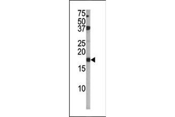 CDKN2A Antikörper  (pSer140)