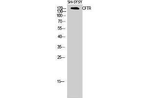 Western Blotting (WB) image for anti-Cystic Fibrosis Transmembrane Conductance Regulator (ATP-Binding Cassette Sub-Family C, Member 7) (CFTR) (Ser246) antibody (ABIN3179947) (CFTR Antikörper  (Ser246))
