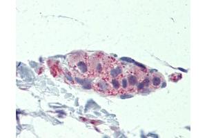 TNKS antibody was used for immunohistochemistry at a concentration of 4-8 ug/ml. (TNKS Antikörper  (Middle Region))