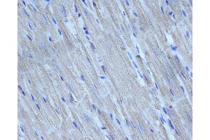 ABIN6276298 at 1/200 staining rat heart tissue sections by IHC-P. (Caspase 3 Antikörper  (N-Term))