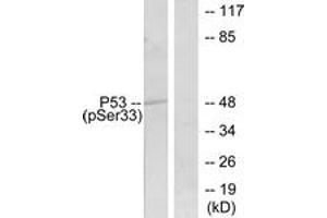 Western blot analysis of extracts from 293 cells treated with UV, using p53 (Phospho-Ser33) Antibody. (p53 Antikörper  (pSer33))